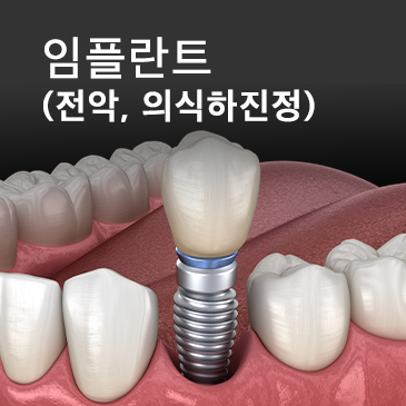 임플란트